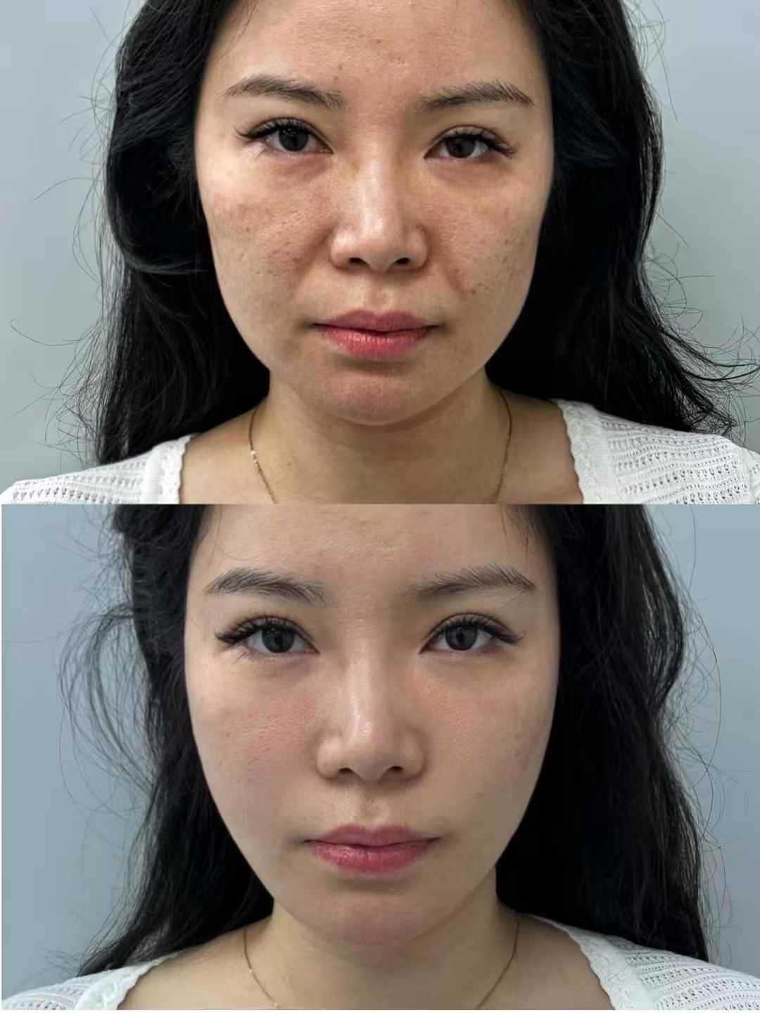 一、李曉東pst成效見(jiàn)證：顧客自述