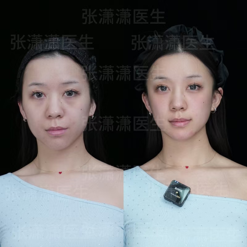 二、周敏茹醫(yī)生打針成效好的原因