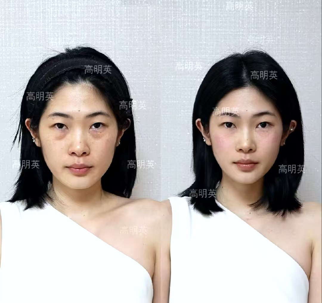 四、周敏茹醫(yī)生的其他技術優(yōu)勢m.sorencai.cn