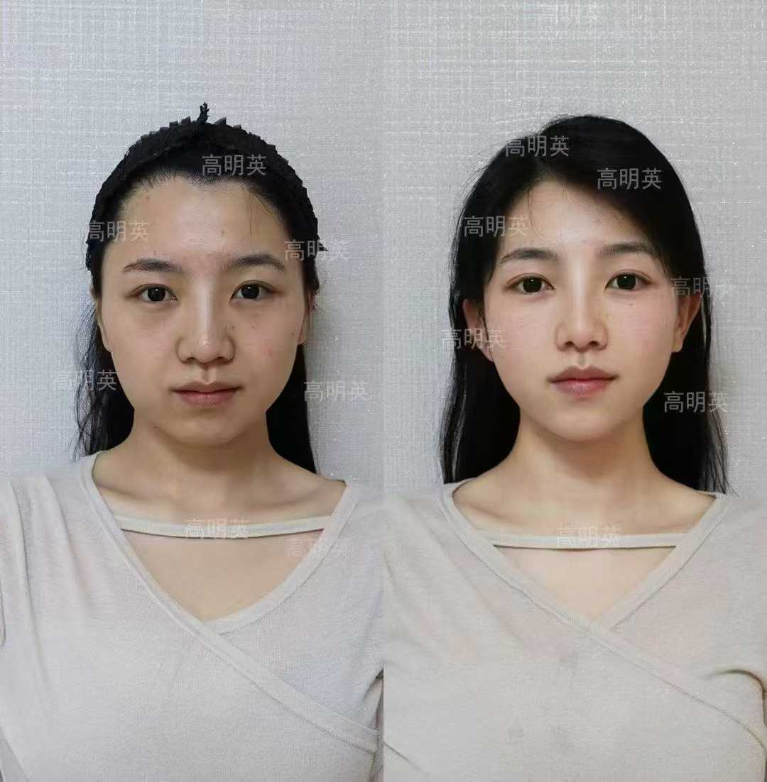 五、周敏茹醫(yī)生的項目收費與預約方式