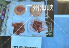 六、為什么荔灣區(qū)醫(yī)院清奧口碑能穩(wěn)十余年？