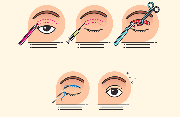 自研技術：創(chuàng)新實力提升競爭力