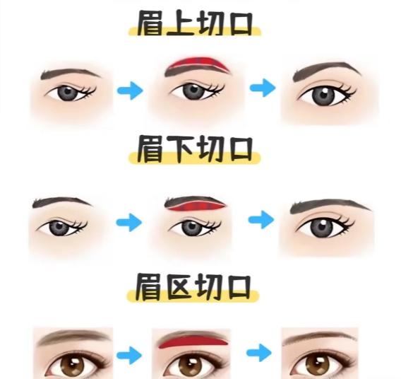 廈門提眉做得好的醫(yī)生推薦！技術(shù)+審美+口碑，精準(zhǔn)鎖定靠譜人選