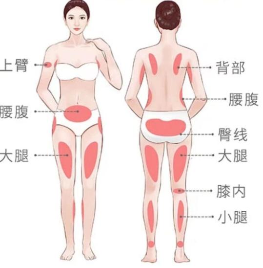 三、關于腰腹吸脂的其他常見疑問解析