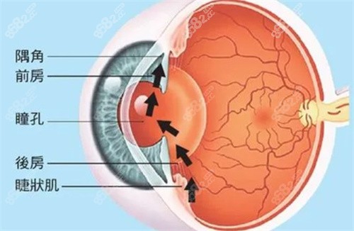 青光眼眼壓高的原因