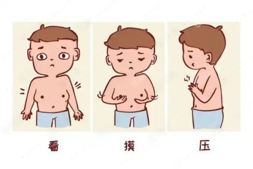 男性乳房發(fā)育吸脂前后對比圖