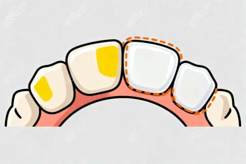 牙齒美白修復(fù)卡通圖