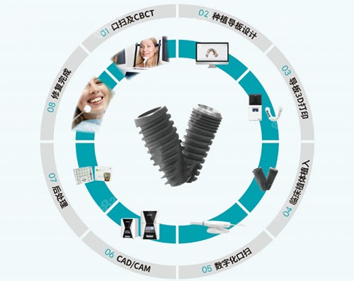 沃蘭種植牙全部流程圖