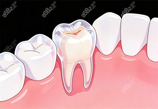 南通海安牙衛(wèi)士口腔在哪？中大街商業(yè)區(qū)，附乘車(chē)路線/預(yù)約電話/價(jià)格表