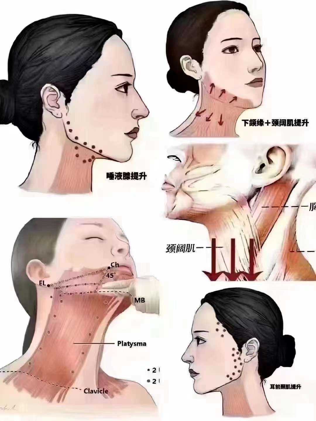 首尔大提升的成效边界与维持时效
