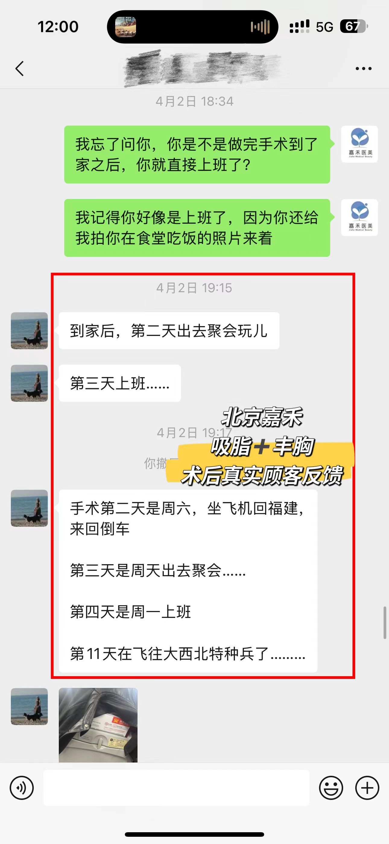 十、誰的脂肪豐胸成活率更高？