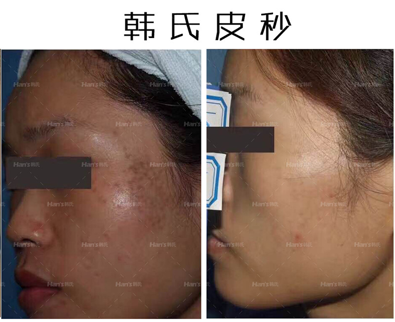 三、沈陽(yáng)杏林醫(yī)院祛斑有啥獨(dú)特之處？