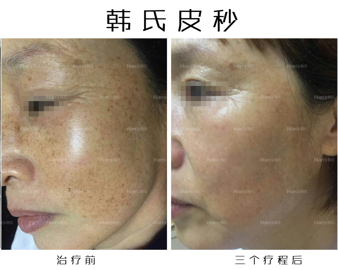 四、沈陽(yáng)百嘉麗醫(yī)療美容醫(yī)院祛斑靠譜嗎？