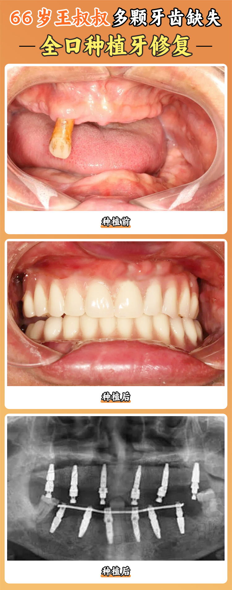 成都華美口腔醫(yī)院技術強在哪？m.sorencai.cn