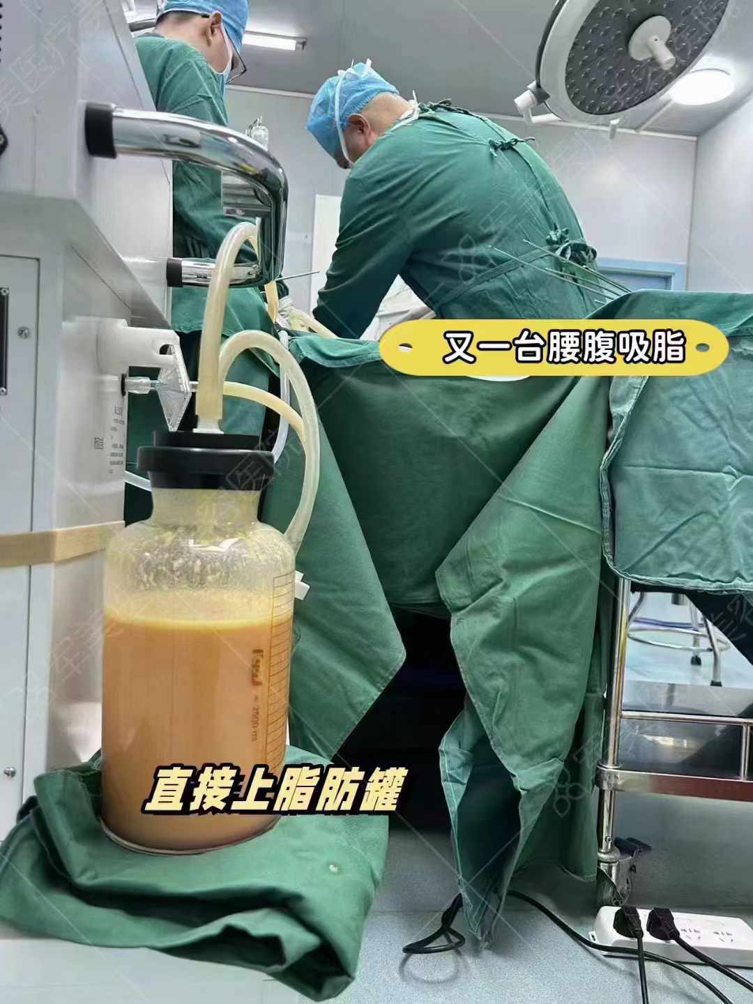 價格透明：廣州藝星吸脂項目參考價