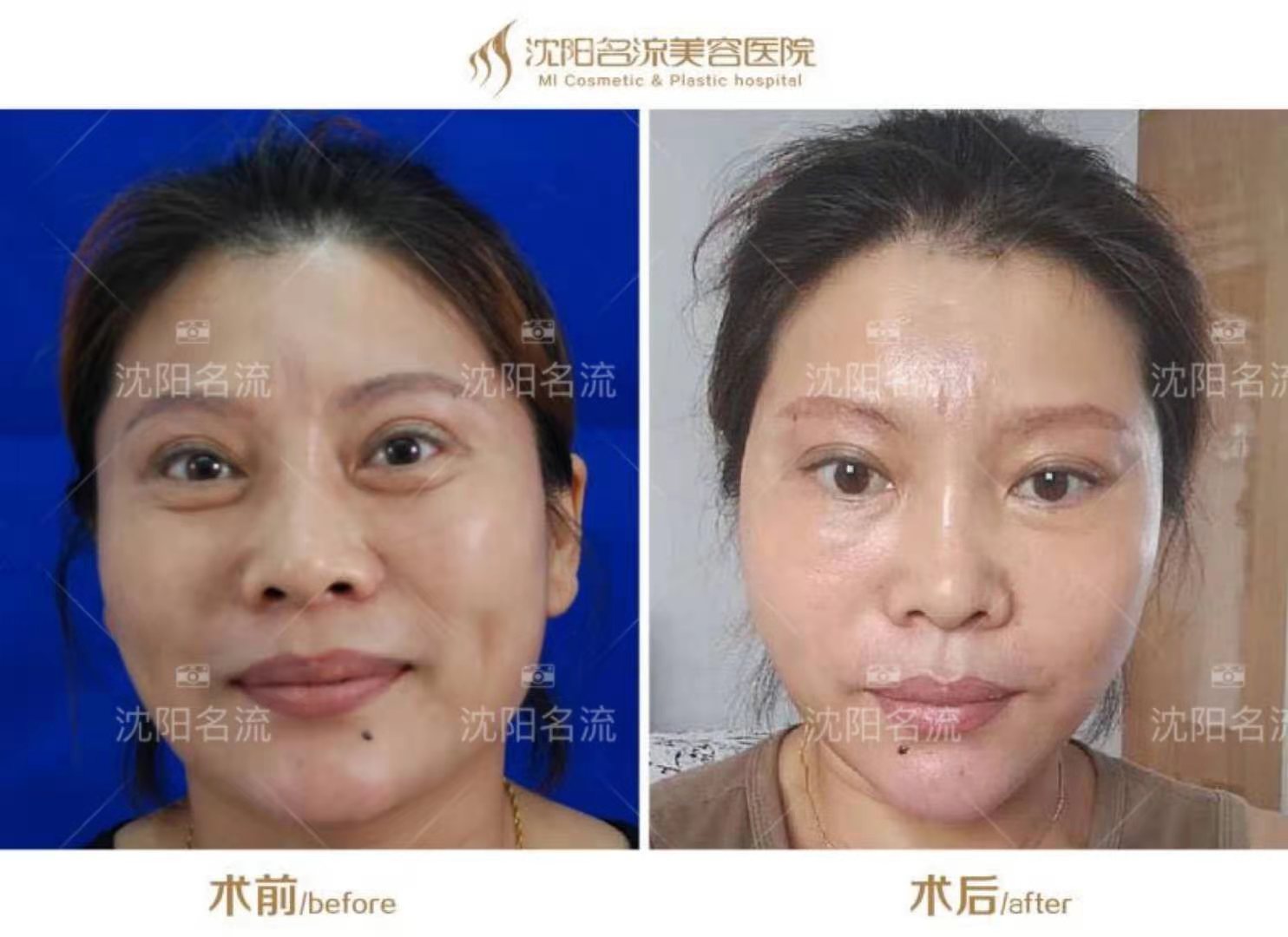 五、黃寺杜太超患者評(píng)價(jià)良好