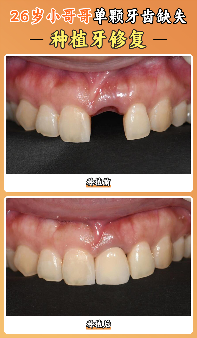 成都華美口腔醫(yī)院資質(zhì)正規(guī)嗎？