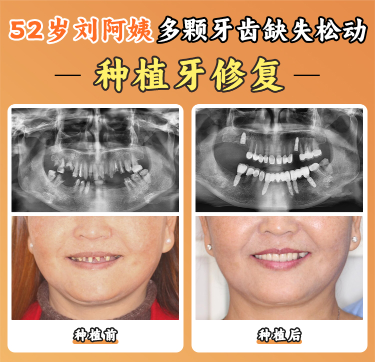 滬申口腔醫(yī)院經(jīng)驗(yàn)多醫(yī)生團(tuán)隊(duì)實(shí)力強(qiáng)