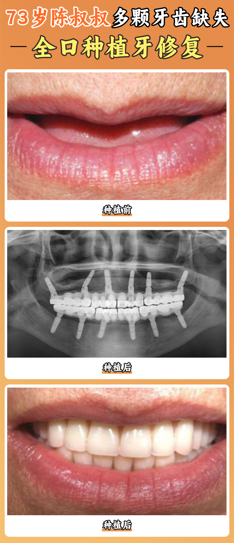 滬申口腔醫(yī)院貼心服務(wù)暖人心