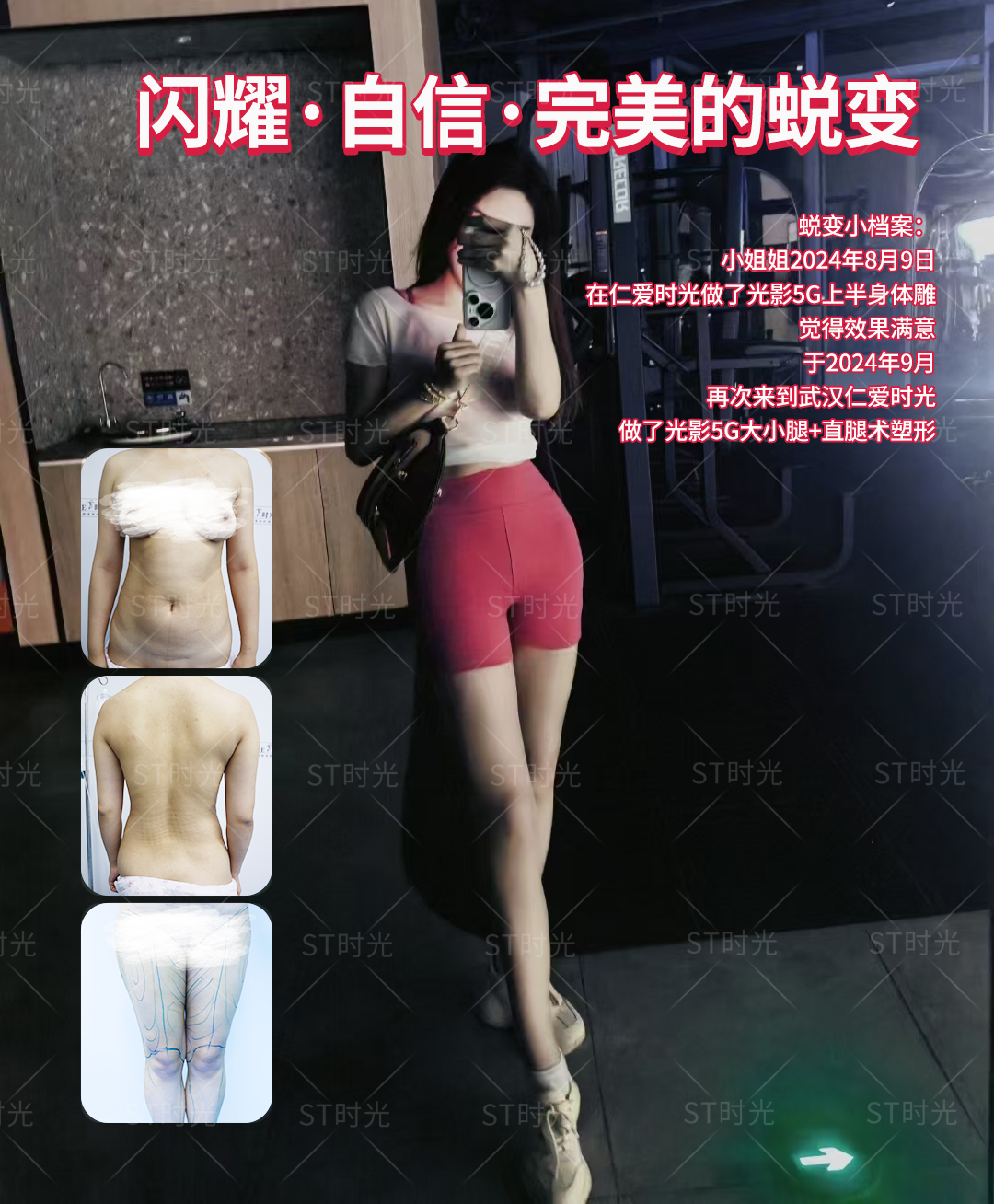 網(wǎng)友腰腹環(huán)吸真實體驗：腰圍實測-10cm