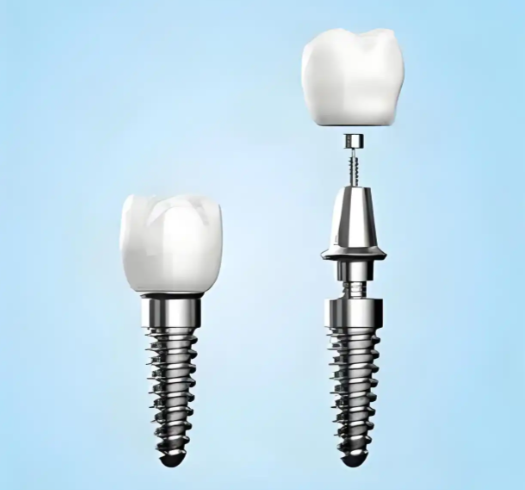 成都華美口腔醫(yī)院顧客評價怎么樣？