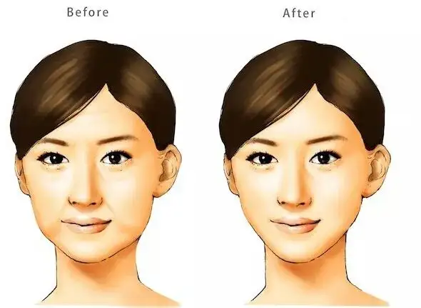 三、李敏醫(yī)生較擅長什么？別跑錯科室了！