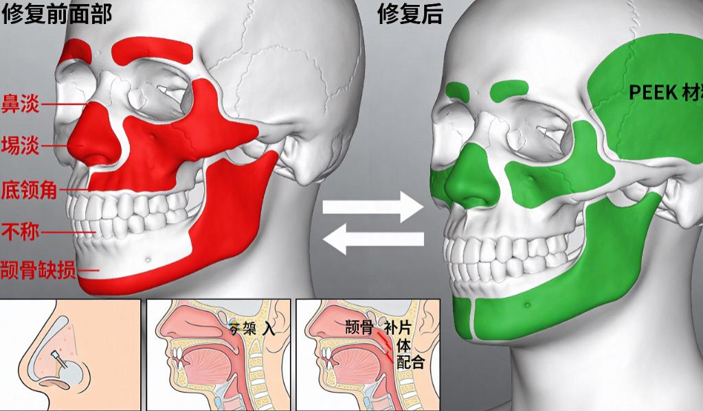 李功哲在哪家醫(yī)院坐診？親測(cè)2026年河南整形美容醫(yī)院掛號(hào)穩(wěn)，peek鼻和自然媽生鼻口碑炸裂