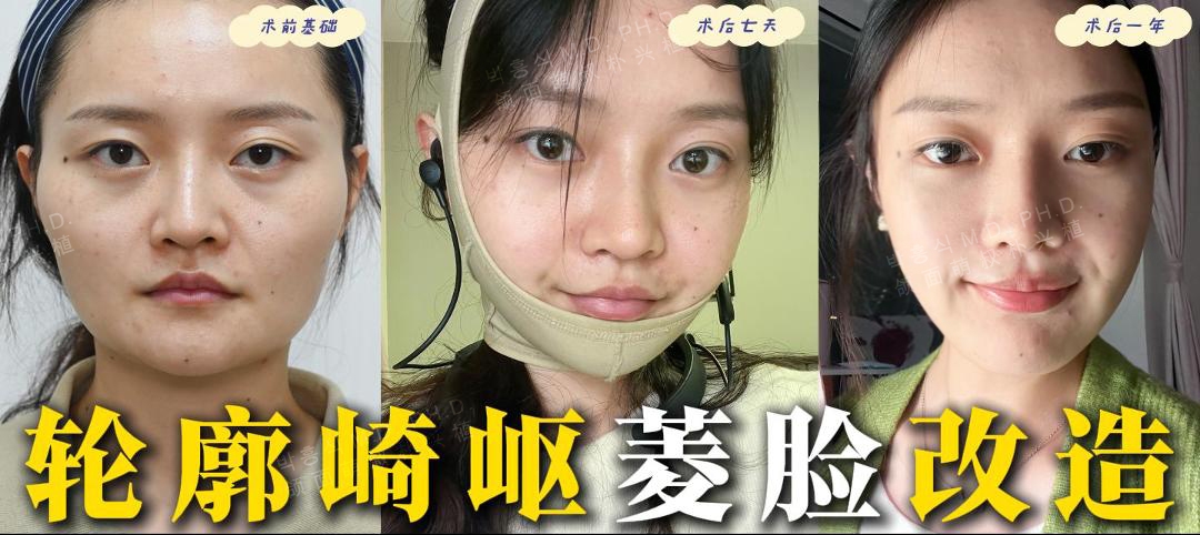 三、張立天磨骨技術(shù)解析