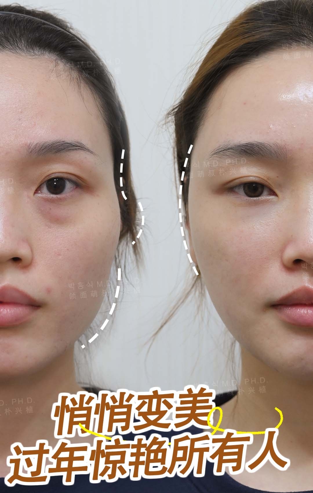 四、張立天磨骨的優(yōu)勢www.sorencai.cn