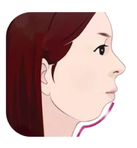 顴骨內(nèi)推技術解析與醫(yī)院推薦