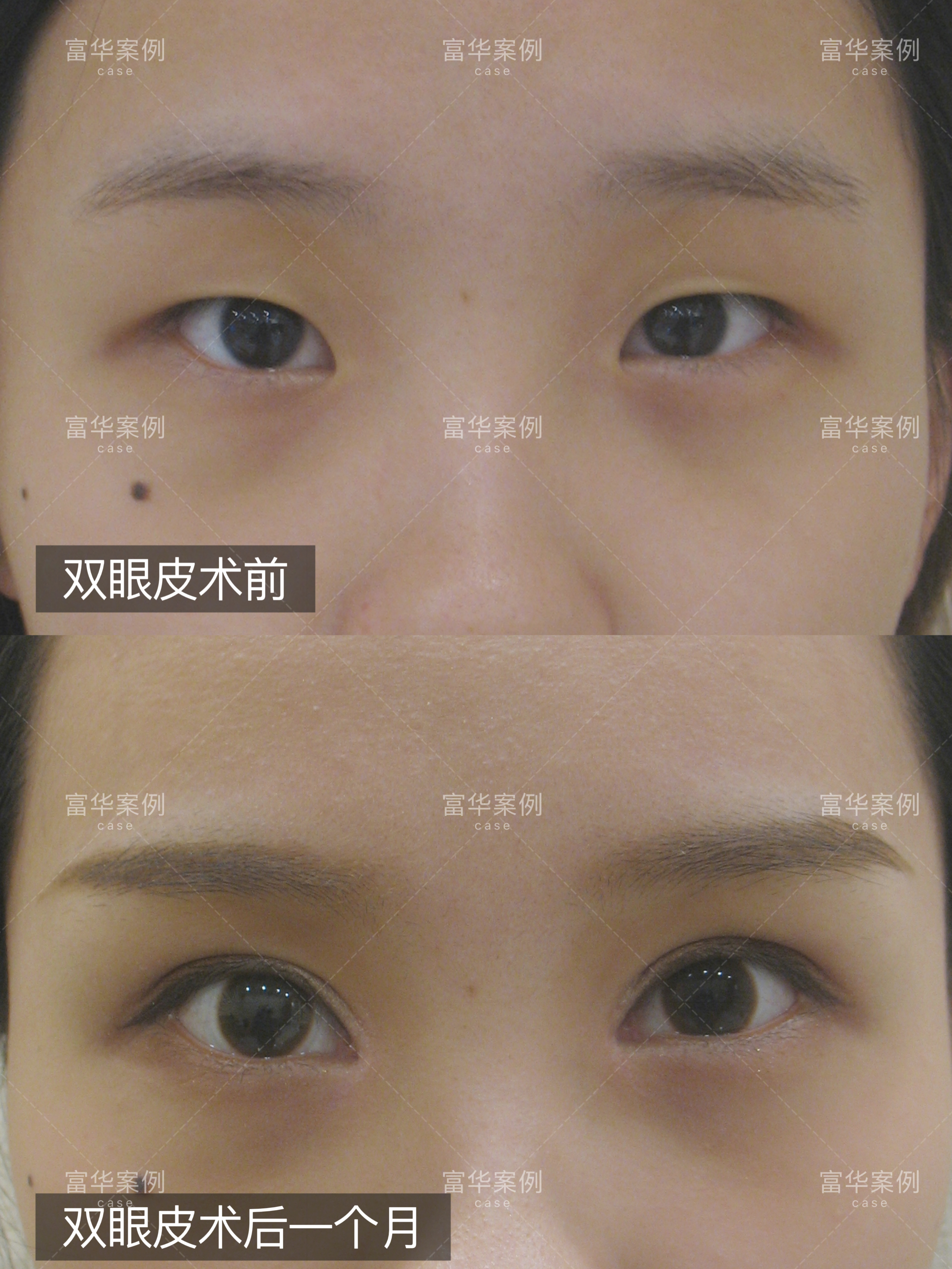 四川紫馨醫(yī)學(xué)美容醫(yī)院：院長親診服務(wù)貼心