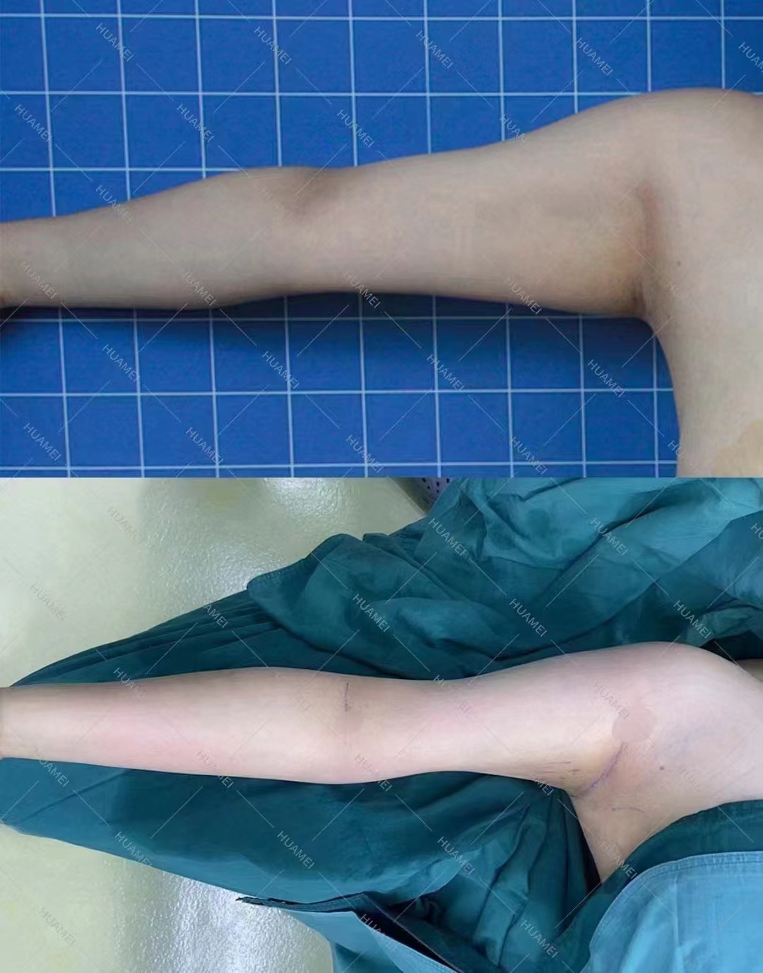 五、廣州軍美王世虎吸脂技術的未來發(fā)展m.sorencai.cn