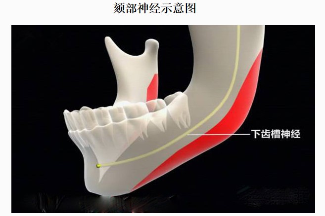 四、磨骨手術(shù)的術(shù)后注意事項及修復(fù)情況m.sorencai.cn