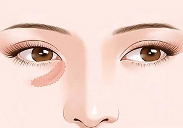 醫(yī)院與醫(yī)生團(tuán)隊(duì)：專(zhuān)精實(shí)力決定自然美感