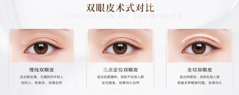 三、 除了價格，大連馮勇醫(yī)生雙眼皮手術(shù)還有哪些看點？