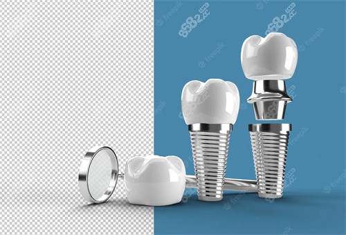 種植牙手術(shù)圖示