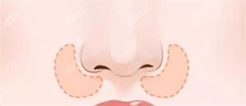 鼻基底鼻部展示圖