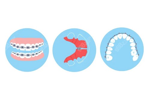 牙齒保持器卡通圖