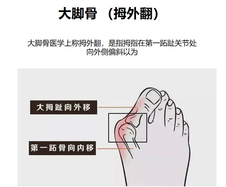 蘇敬達(dá)私立醫(yī)院靠譜嗎？2026北京圣嘉新實(shí)測(cè)：四級(jí)手術(shù)資質(zhì)+中高端，拇外翻矯正9980元起