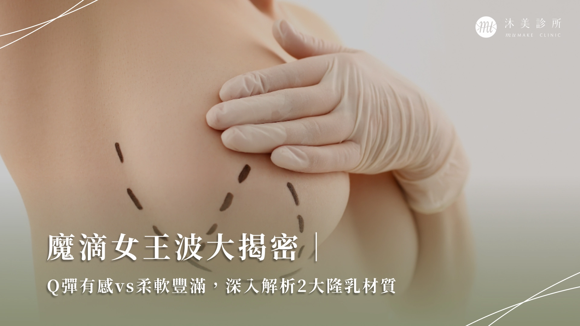 七、長(zhǎng)沙祺美胸整形，實(shí)力與美學(xué)的結(jié)合