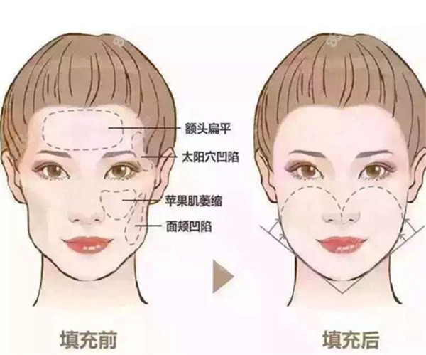 廣州私密整形醫(yī)院排名前列醫(yī)院