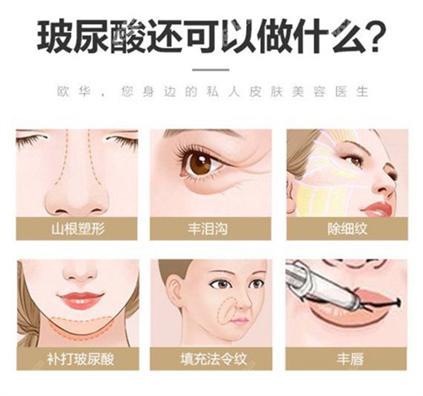 溫州打玻尿酸排名前十醫(yī)院