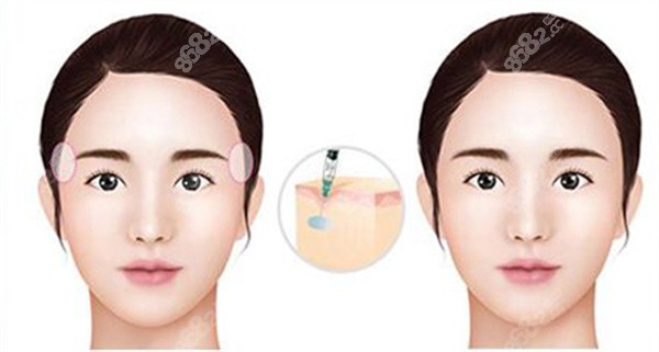 廣州私密整形醫(yī)院排名前列醫(yī)院