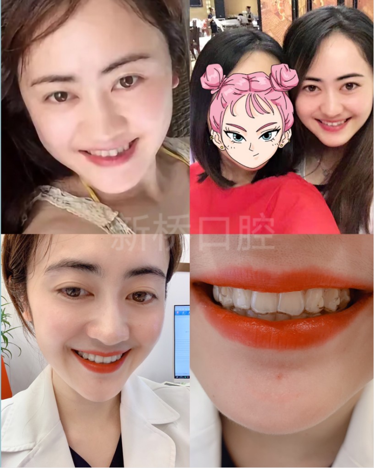 为什么会大小脸？咀嚼习惯、先天发育等是面部不对称的常见诱因及改善提示