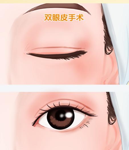 四、为什么田怡医生的眼修复设计能兼顾动态与静态美？