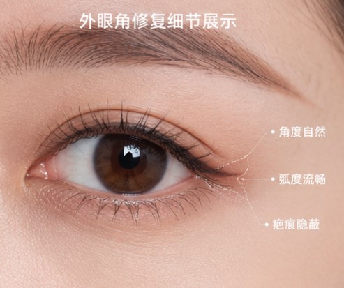 三、如何有效完成重庆田怡双眼皮修复的预约面诊？