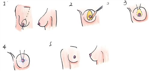国内十大乳房下垂矫正医生排名出炉，北京美莱高超、艺星于双全都上榜
