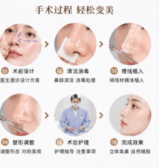 三、关于王会勇隆鼻价格与“毁容”传闻的客观分析