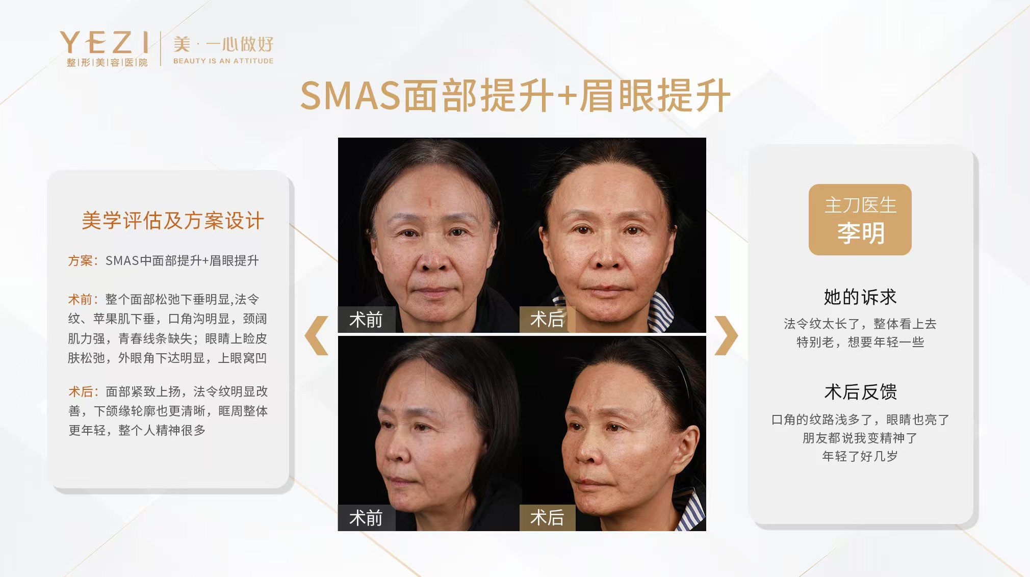 热玛吉和超声炮哪个好：抗初老场景对比