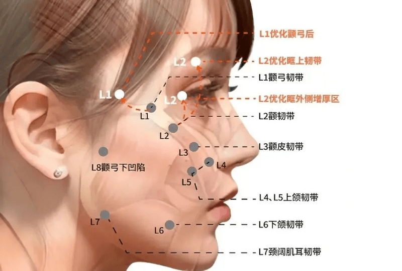 四、济南王召东医生的筋膜固定技术解析www.8682.cc